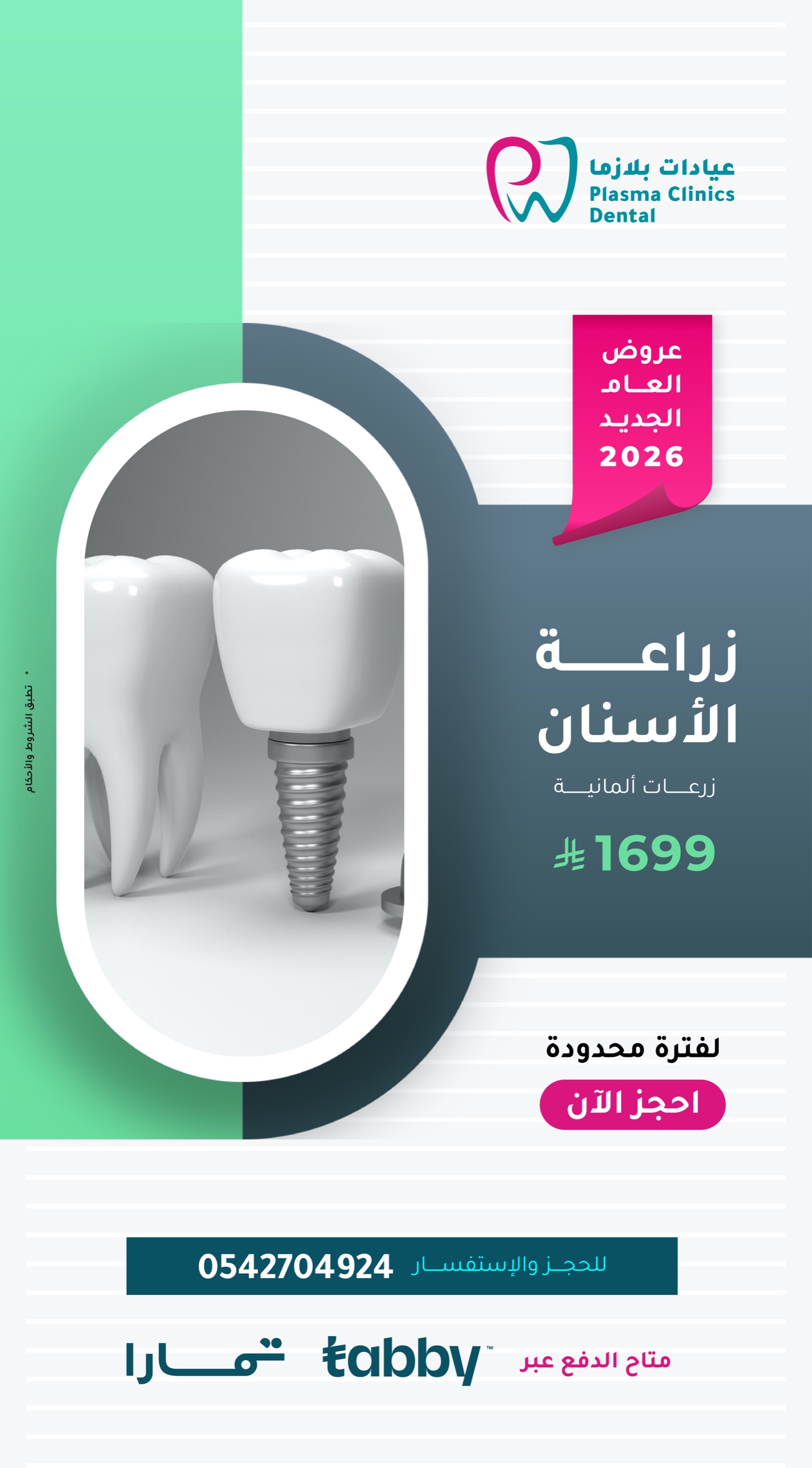 "إعلان عروض العام الجديد 2026 لزراعة الأسنان في عيادات بلازما، يظهر زرعة أسنان ألمانية وسعر العرض 1699 ريال مع شعار تمارا وتابي."