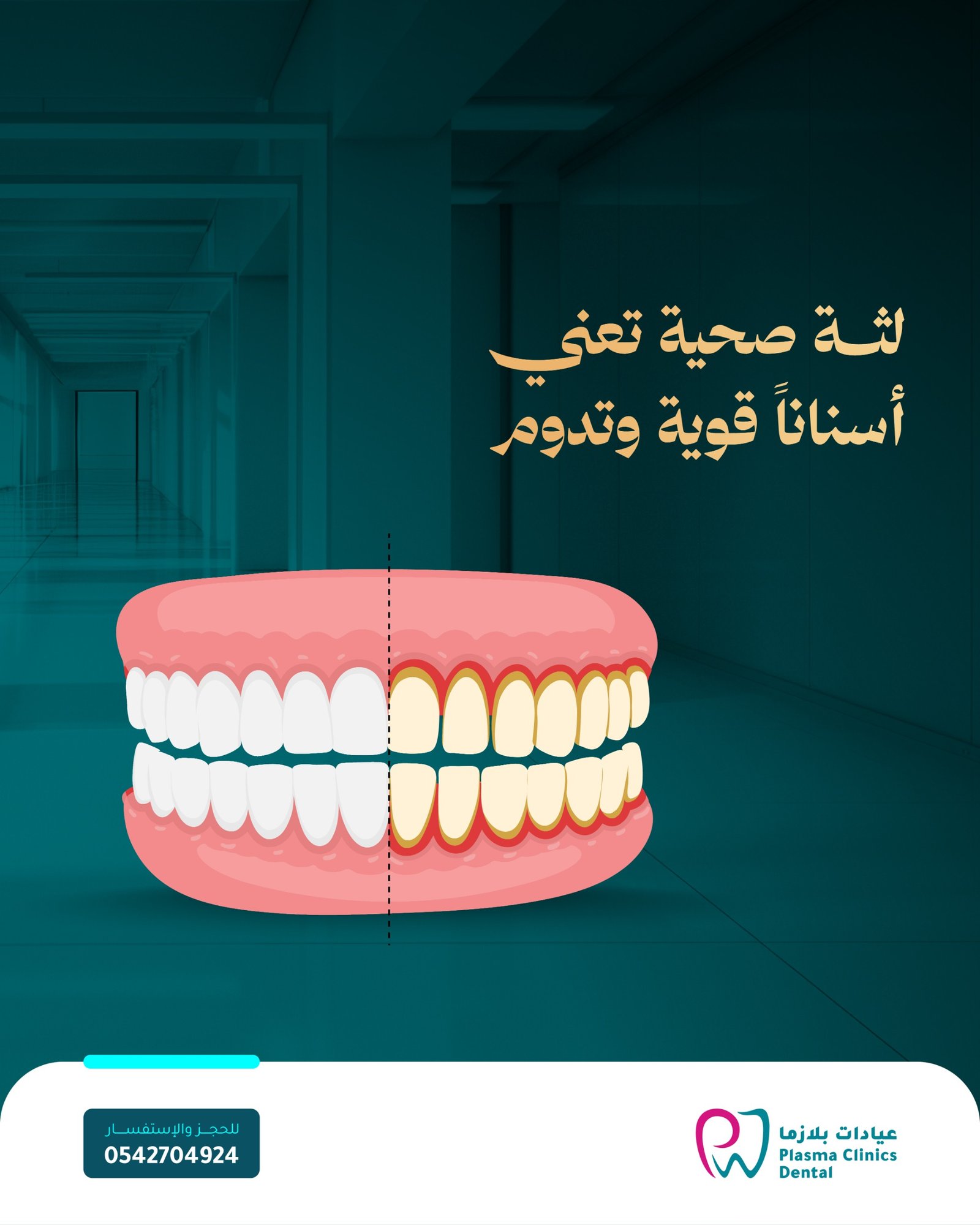 رسم توضيحي لفك أسنان ينقسم إلى جزأين: جزء لثة صحية وأسنان بيضاء، وجزء لثة ملتهبة وأسنان صفراء، مع عبارة "لثة صحية تعني أسناناً قوية وتدوم" لعلاجات اللثة.